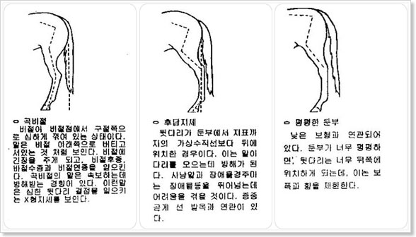 �����, �Ĵ�����, ������ �к� �� �������� �޴ٸ� �ܸ�